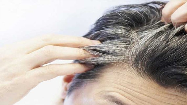 পাকা চুলের সঙ্গে ক্যান্সারের যোগসুত্র নিয়ে যা বলছে গবেষণা